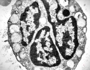 M,18y. | blood - basophilic granulocyte